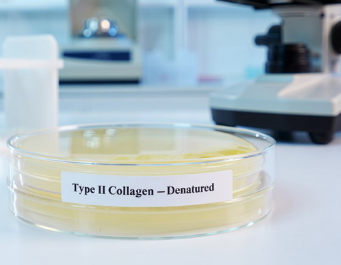 Denaturatsiyalangan II tip kollagen